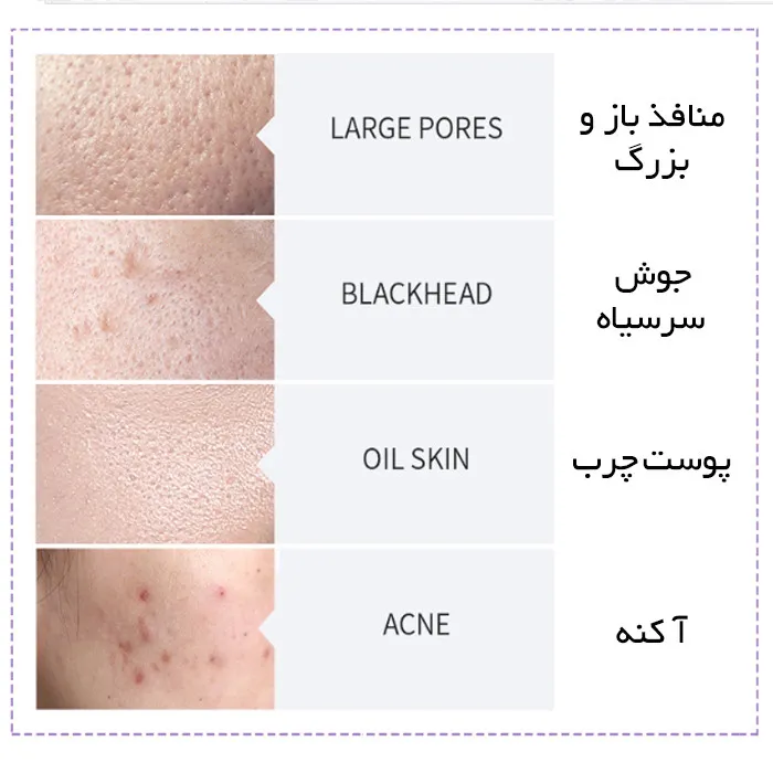 دستگاه جوانسازی کارینا مدل 103 - تصویر 4