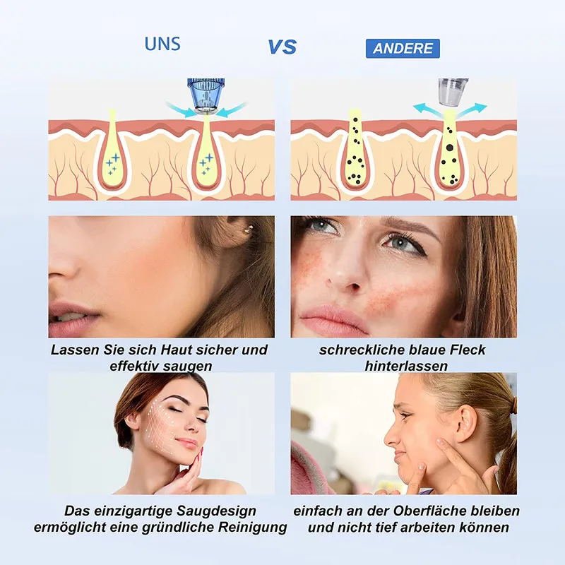 میکرودرم خانگی مدل Blackhead Remover M206 - تصویر 3