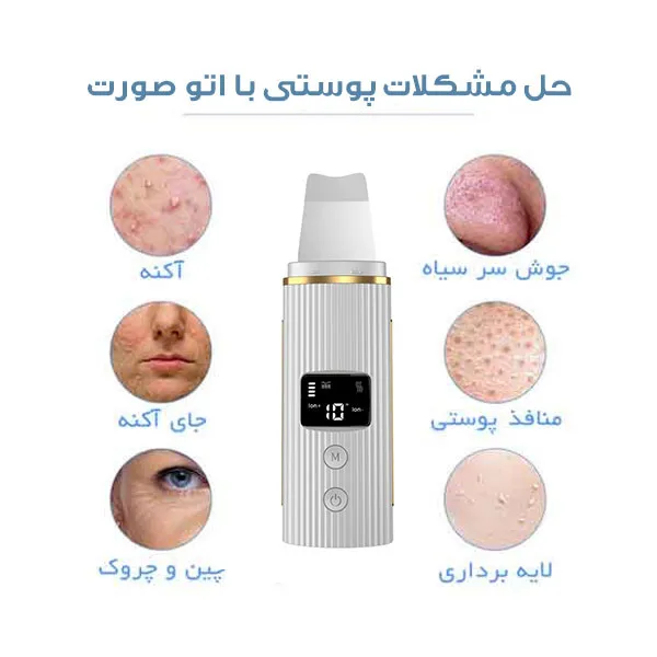 اتوی صورت مدل 8818 - تصویر 5
