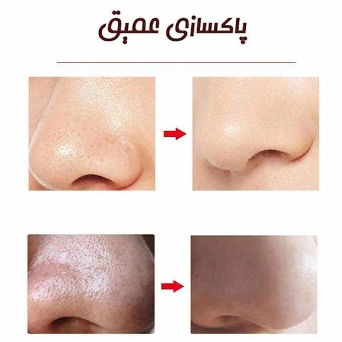 میکرودرم خانگی مدل MCOO4 - تصویر 3