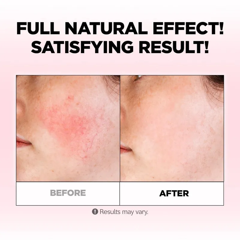 کرم آبرسان فارم اسکین مدل Soothing حجم 100 میلی لیتر  - تصویر 2