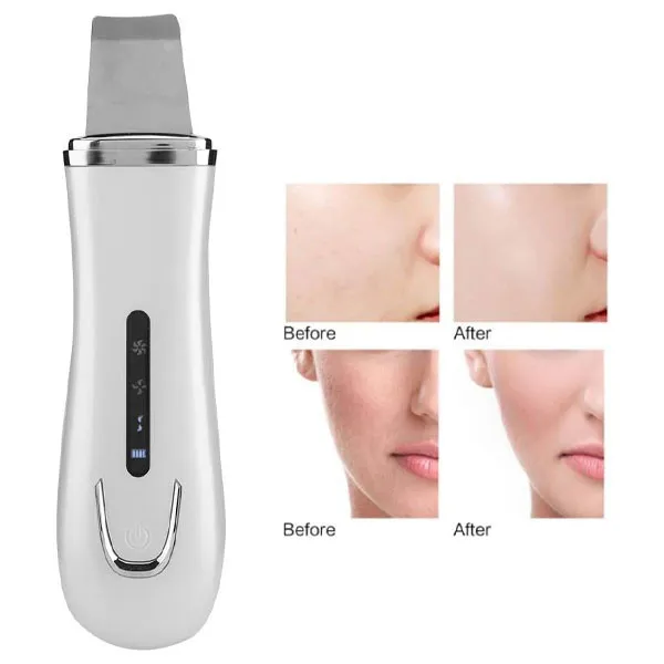 دستگاه پاکسازی پوست مدل JZC-C001 - تصویر 2