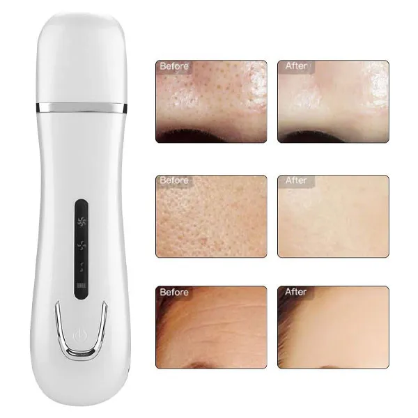 دستگاه پاکسازی پوست مدل JZC-C001 - تصویر 5