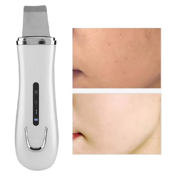 دستگاه پاکسازی پوست مدل JZC-C001 - تصویر 6