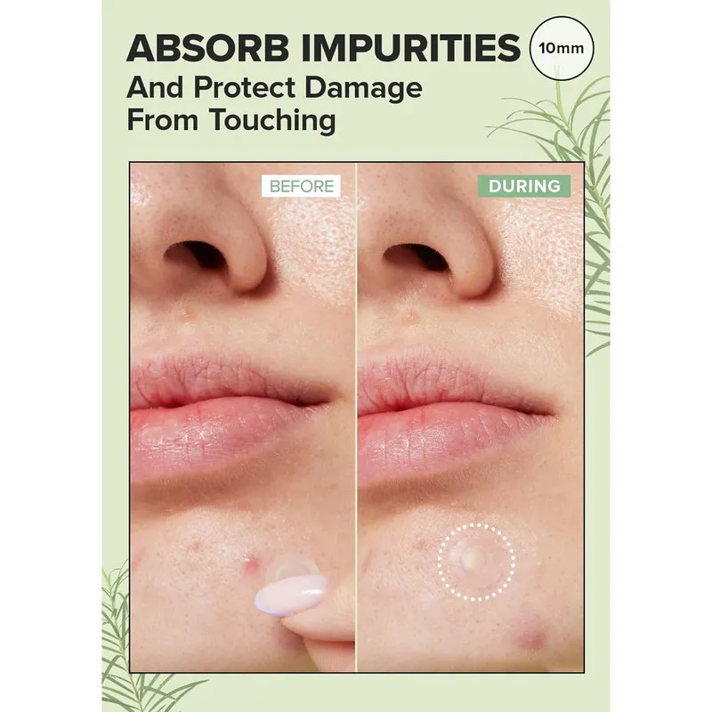 چسب ضد جوش پنرول مدل PRD Acne Cover Patch 360 بسته 36 عددی - تصویر 6