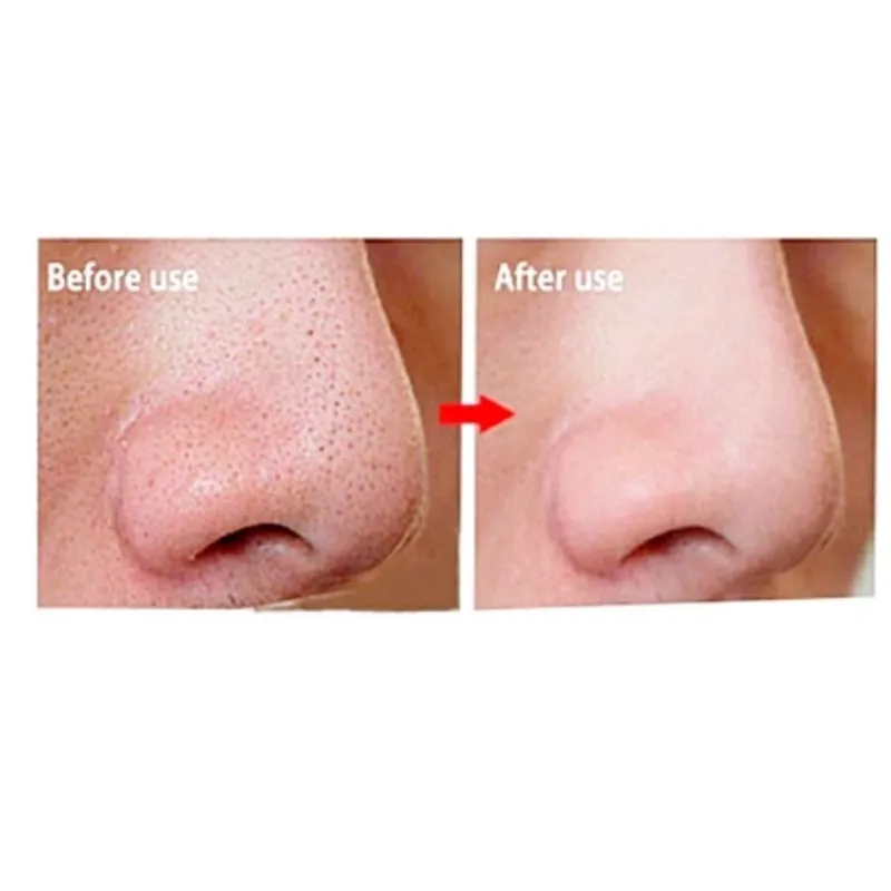 چسب پاک کننده بینی ویونسا مدل چای سبز حجم 17 میلی لیتر - تصویر 4