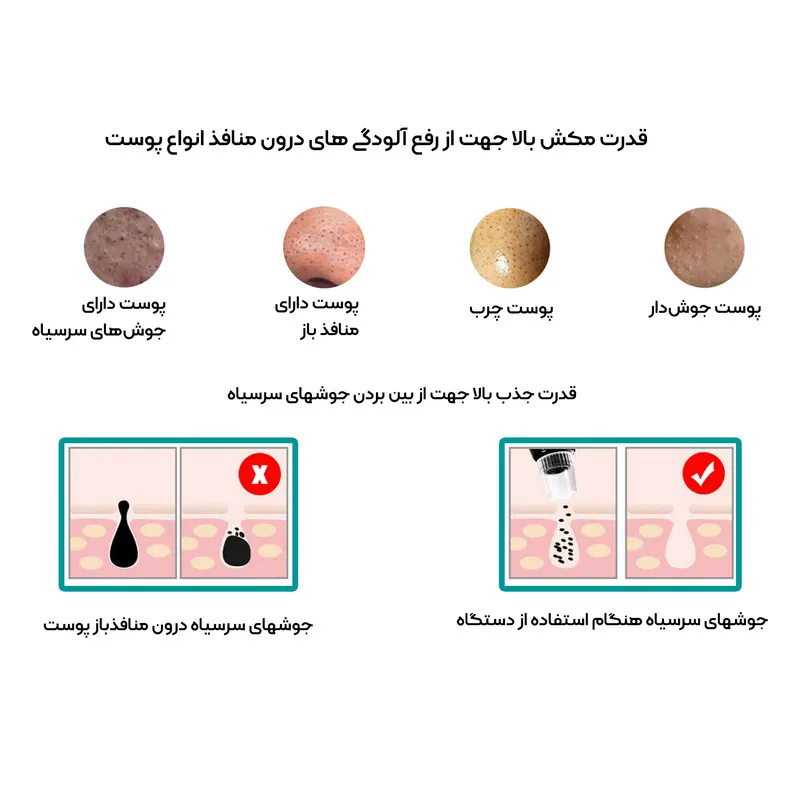 میکرودرم خانگی مدل JHF15 - تصویر 6