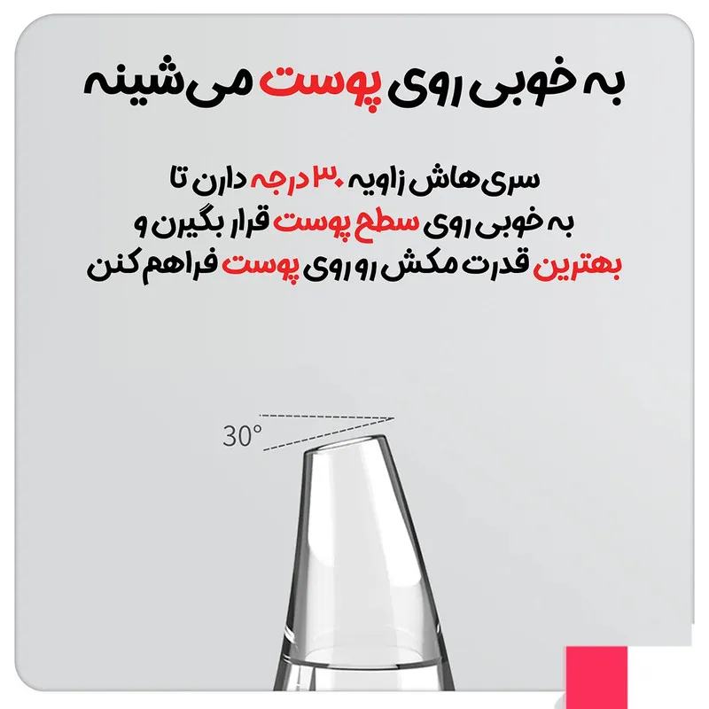 میکرودرم خانگی اینفیس مدل MS7000 - تصویر 3