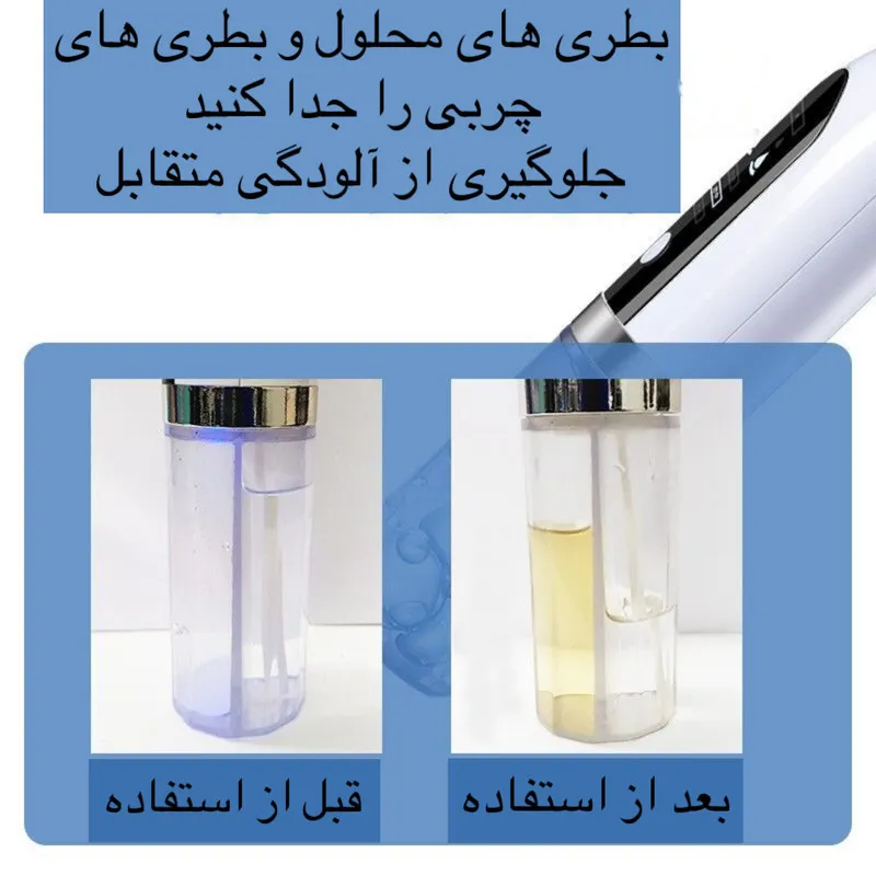 میکرودرم خانگی مدل Super Micro Bubble - تصویر 2