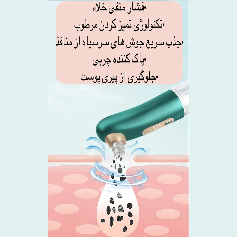 میکرودرم خانگی مدل X17 - تصویر 4