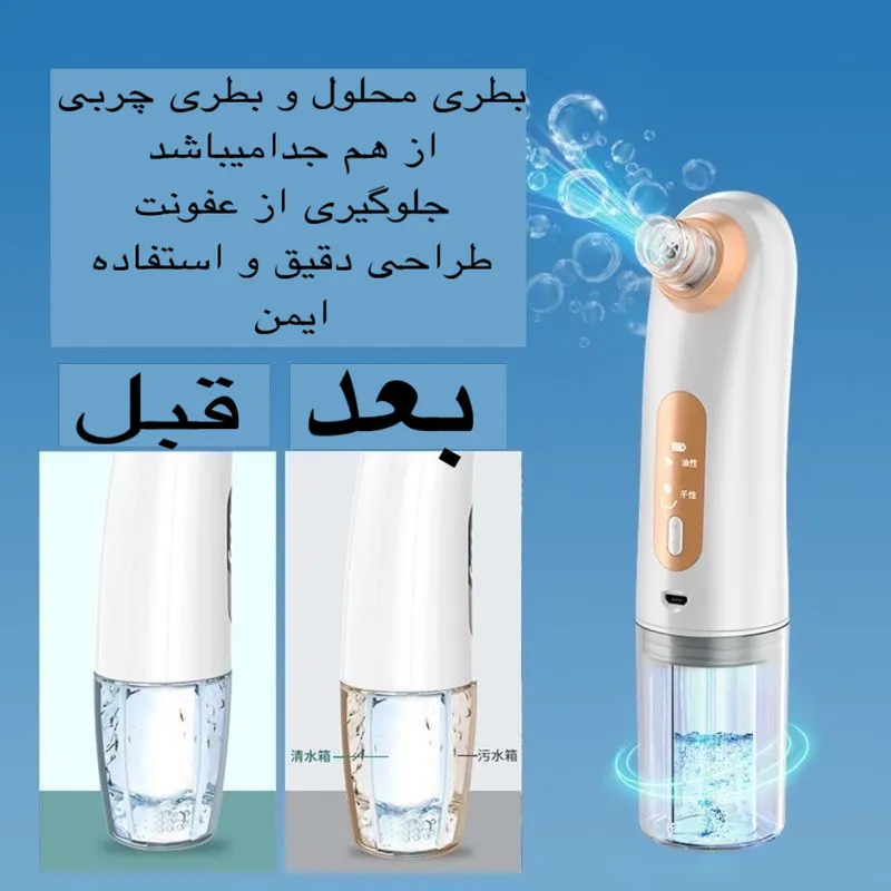 میکرودرم خانگی مدل X17 - تصویر 6