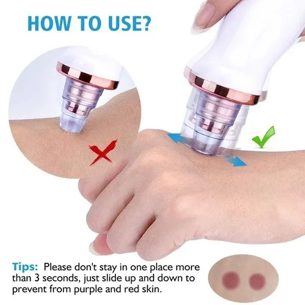 میکرودرم خانگی مدل BR-8821 - تصویر 5