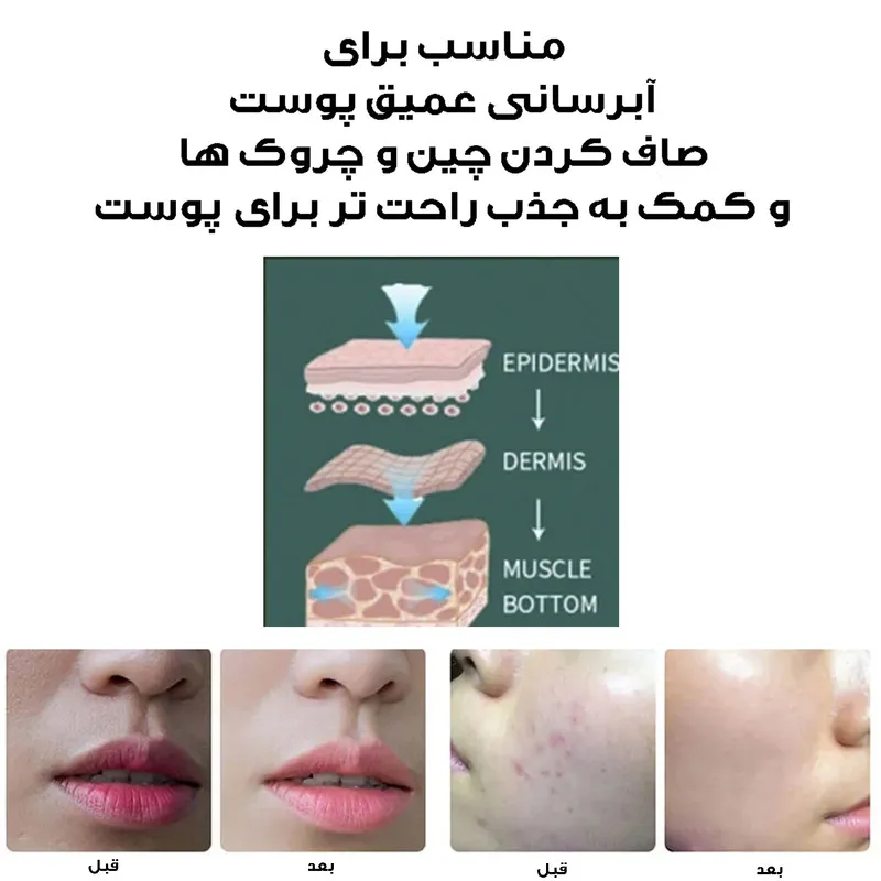 دستگاه آبرسان پوست مدل ZM152 - تصویر 6