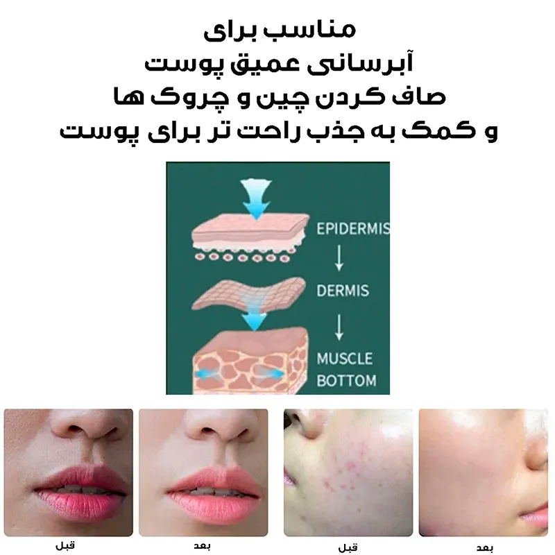 دستگاه آبرسان پوست کد ZM150 - تصویر 4