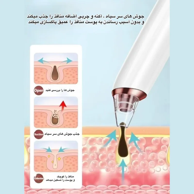 میکرودرم مدل KNY_E27 - تصویر 6