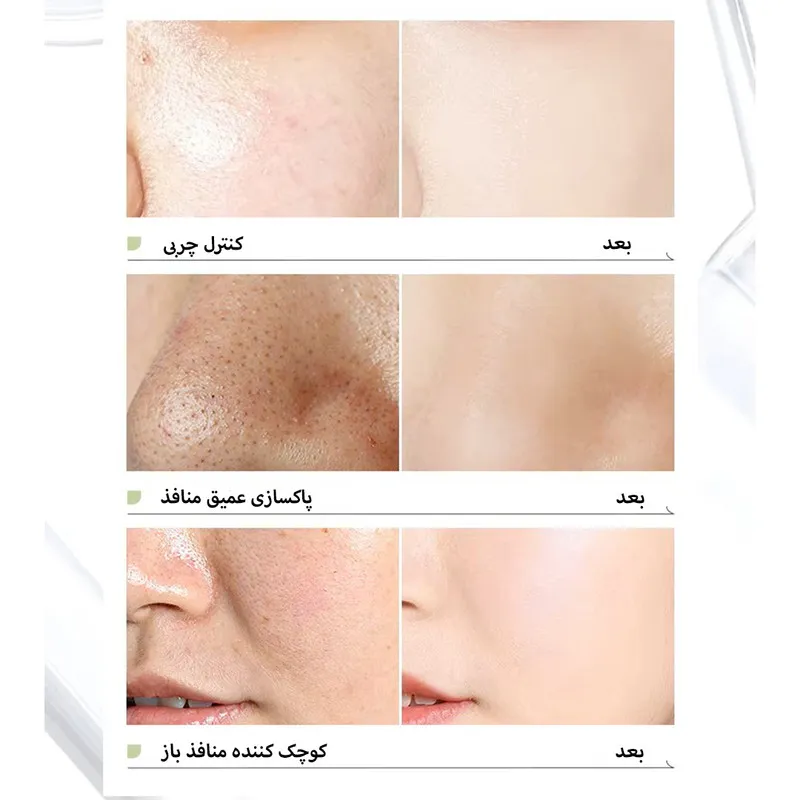 ماسک صورت لایکو مدل ماگورت وزن 100 گرم - تصویر 2