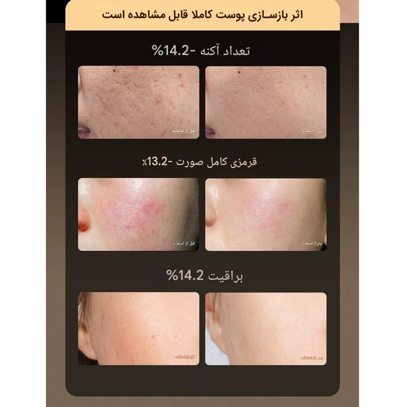 دستگاه فتوتراپی جوانساز صورت بنکس مدل Foton - تصویر 4