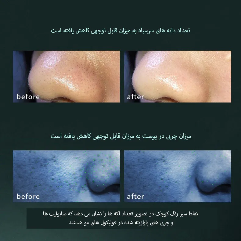 دستگاه آبرسان و پاکسازی پوست مدل lrenbang - تصویر 5