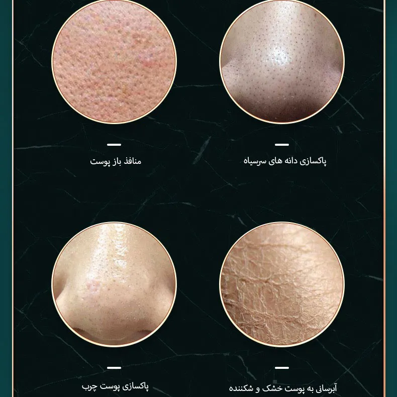 دستگاه آبرسان و پاکسازی پوست مدل lrenbang - تصویر 6