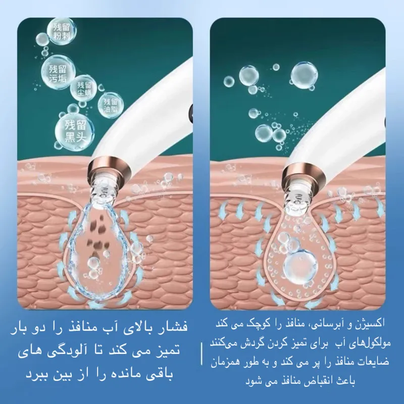 میکرودرم مدل X13 - تصویر 6