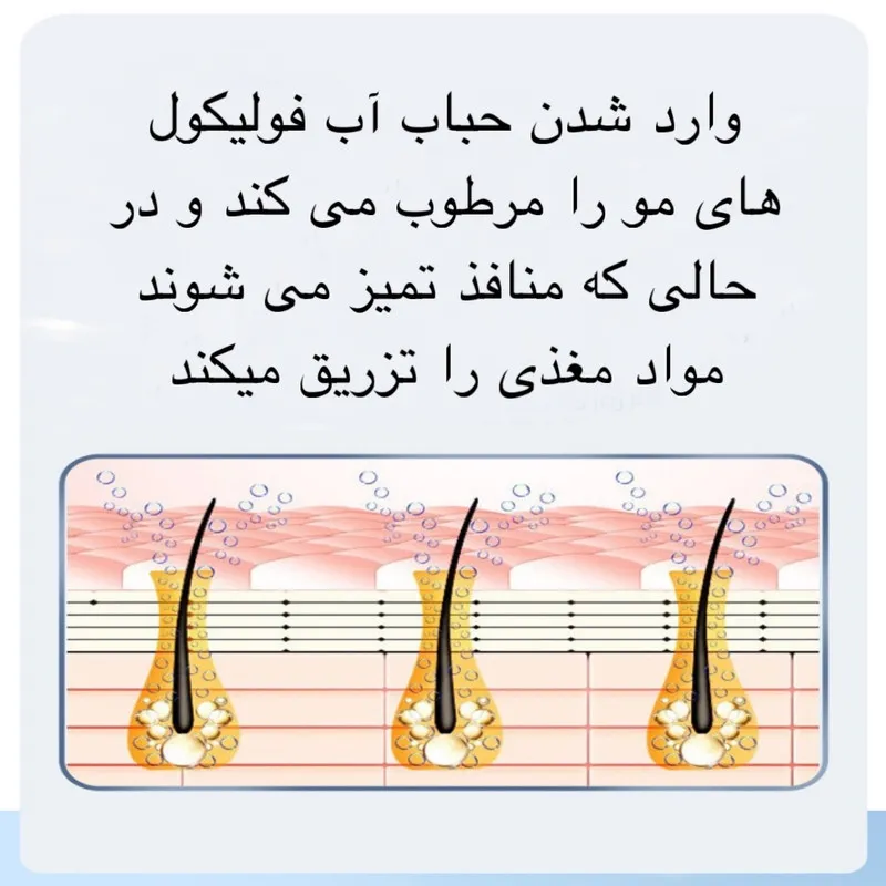 میکرودرم مدل X19 - تصویر 6
