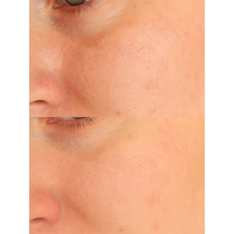 ژل فوم شستشو صورت روشن کننده سانتلا مدل ماداگاسکار مناسب برای پوست های معمولی حجم 125 میلی لیتر - تصویر 5