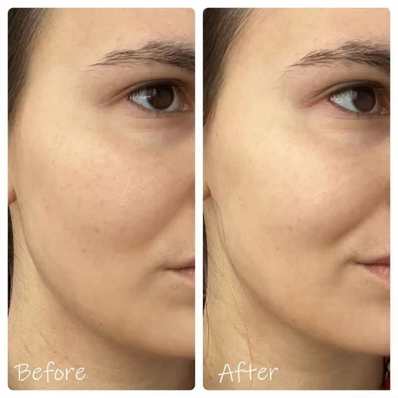 تونر سنتلا مدل HYALU-CICA Brightening حجم 210 میلی لیتر - تصویر 4