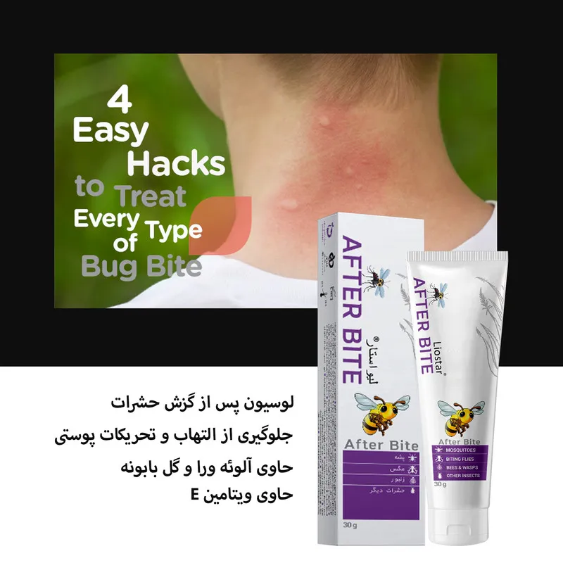 لوسیون پس از گزش حشرات بدن لیواستار مدل برگ ریحان مناسب برای انواع پوست وزن 30 گرم - تصویر 3