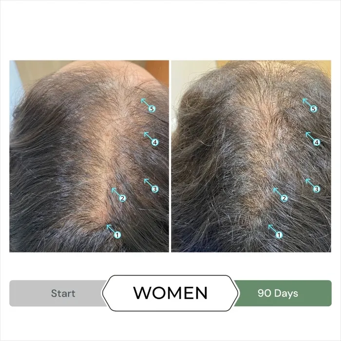 شامپو تقویت کننده و ضد ریزش مو دی اس لابراتوریس مدل Revita.CBD مناسب برای انواع مو حجم ۲۰۵ میلی لیتر - تصویر 3