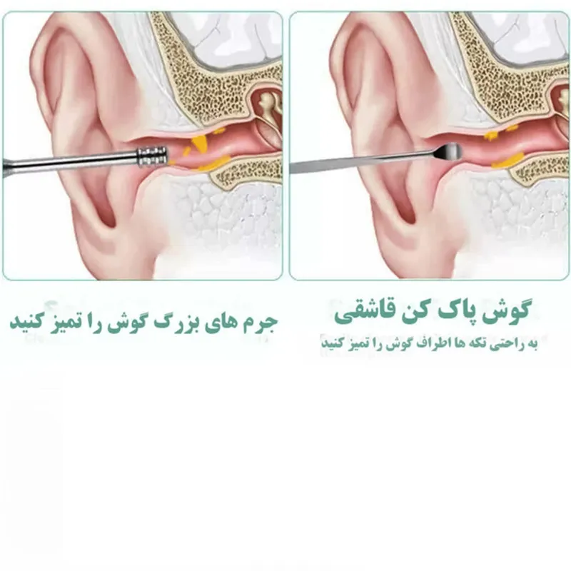 مجموعه نظافت گوش مدل Ear Care-02  بسته 6 عددی - تصویر 6