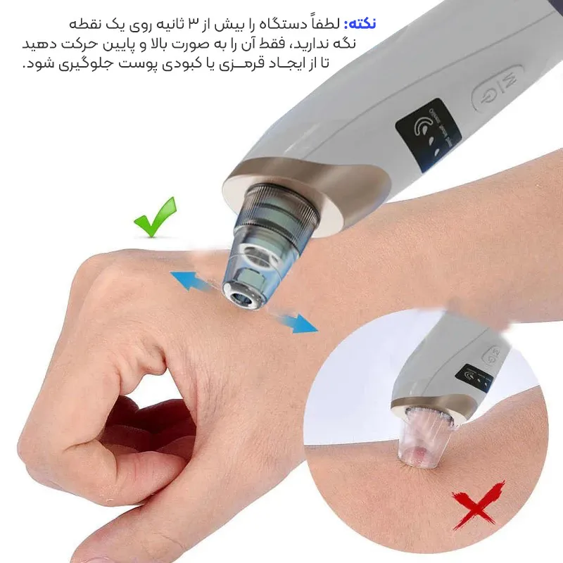 میکرودرم مدل New8826 - تصویر 4
