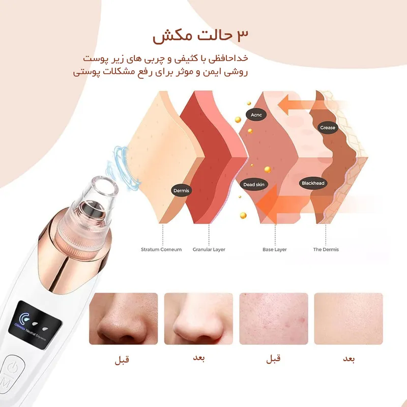 میکرودرم لوتوکس مدل LT-360 - تصویر 5