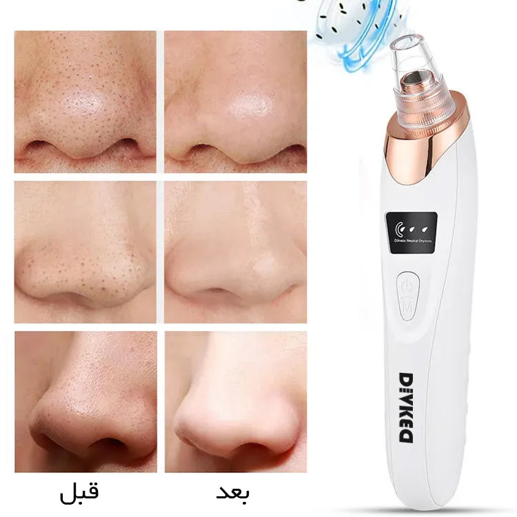 میکرودرم دیوکید مدل DD-1022 - تصویر 2