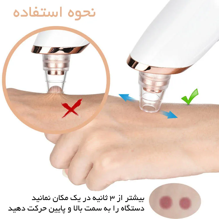 میکرودرم دیوکید مدل DD-1022 - تصویر 4