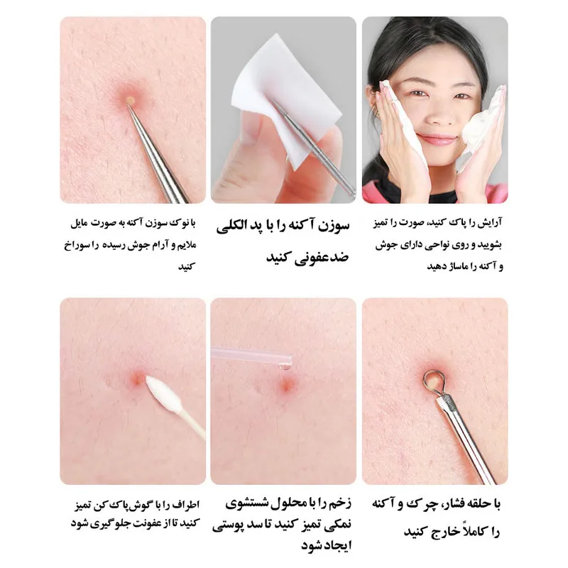 مجموعه ابزار پاک‌سازی پوست جیکومو مدل Anti-Acne بسته 8 عددی - تصویر 6