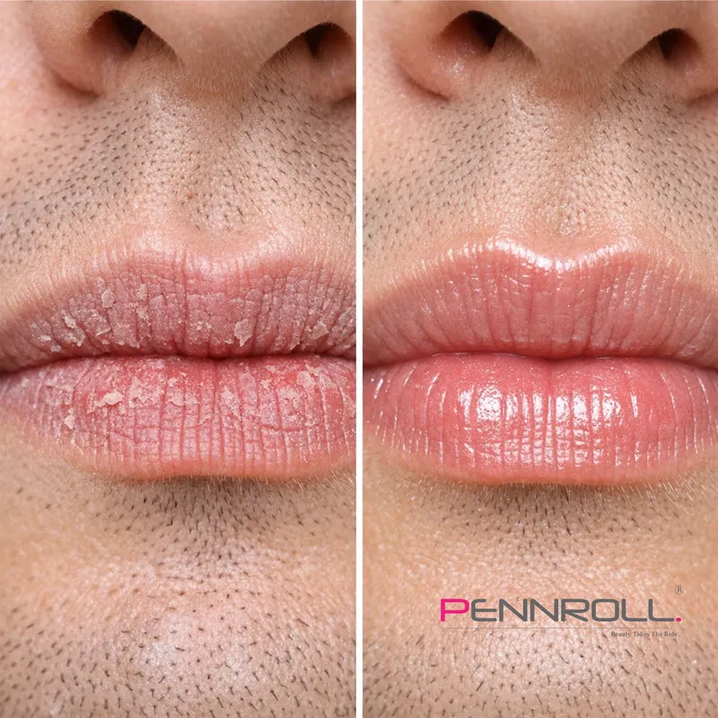  ماسک لب پنرول مدل PRD - Collagen Smile Repair مناسب برای انواع پوست وزن 6 گرم مجموعه 3 عددی - تصویر 3