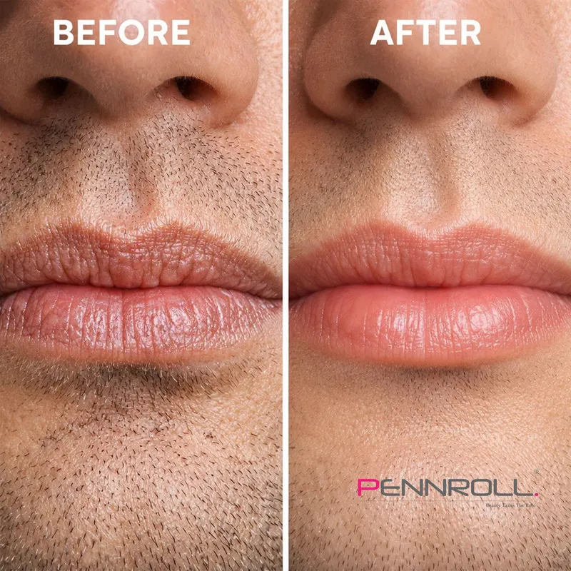  ماسک لب پنرول مدل PRD - Collagen Smile Repair مناسب برای انواع پوست وزن 6 گرم مجموعه 3 عددی - تصویر 4