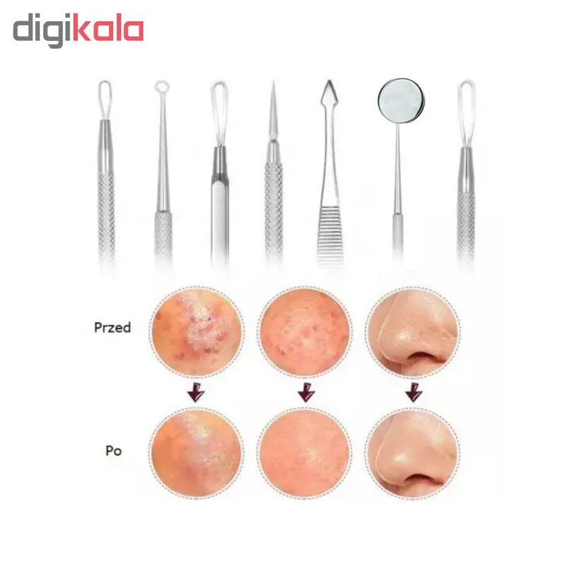 مجموعه ابزار پاک‌سازی پوست کیو وای اچ مدل derm-3198 بسته 7 عددی - تصویر 2