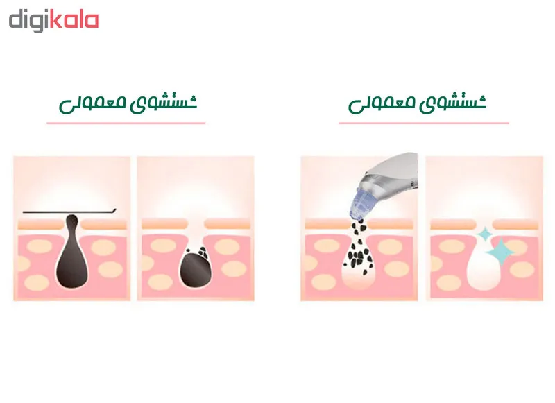 میکرودرم پاریس استایل مدل MICROLE - تصویر 6