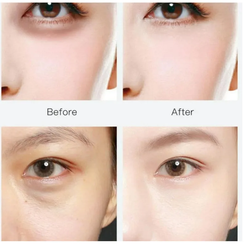 ماسک زیر چشم بایو آکوا مدل HYDRATING MOISTURIZING حجم 80 میلی لیتر بسته 60 عددی - تصویر 3