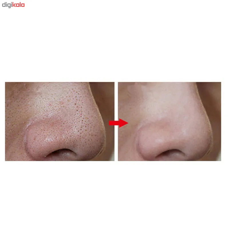 ماسک صورت بایو آکوا
مدل بامبو حجم 140 میلی لیتر - تصویر 5