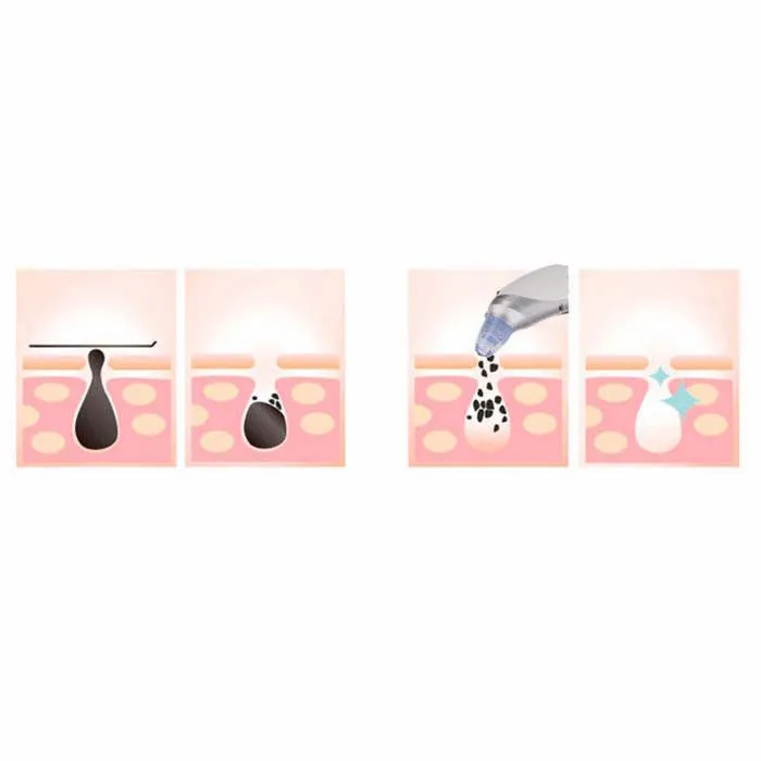 میکرودرم گلویش استایل مدل MR-69 - تصویر 5