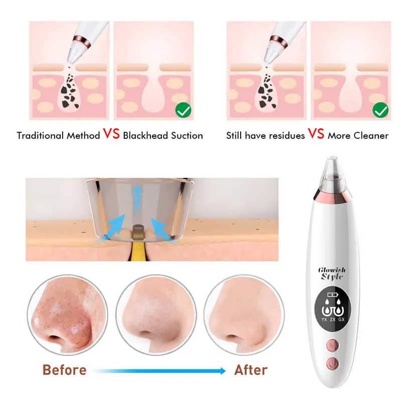 میکرودرم گلویش استایل مدل MD-63 - تصویر 5