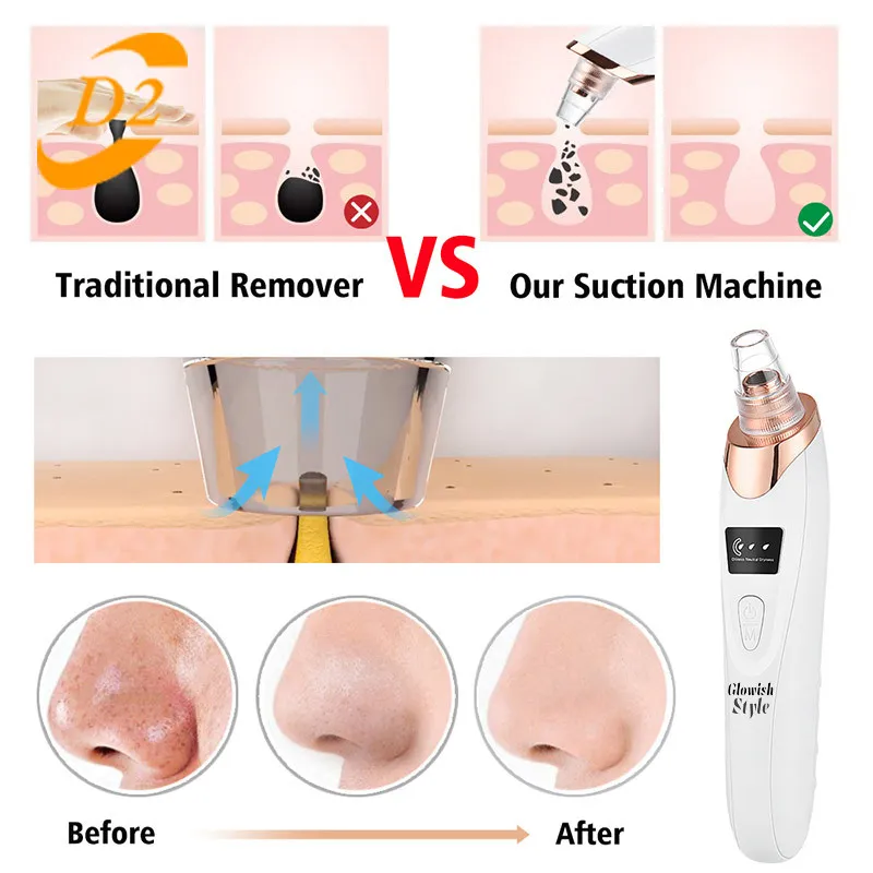 میکرودرم گلویش استایل مدل MF-76 - تصویر 2