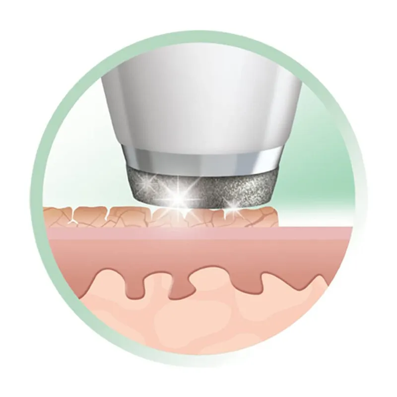 میکرودرم رمینگتون مدل REVEAL DIAMOND MD3000 - تصویر 4