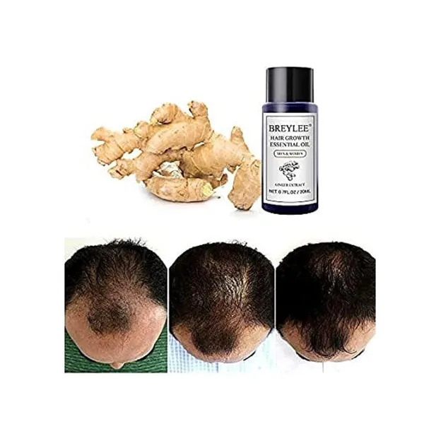 روغن ضد ریزش مو بریلی مدل جنسینگ حجم 20 میلی لیتر - تصویر 3