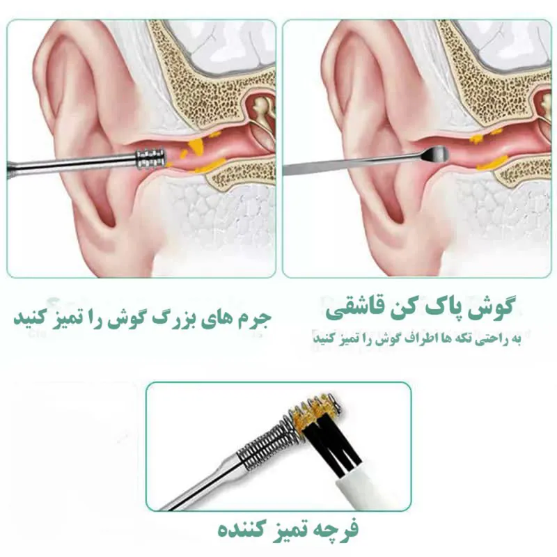 گوش پاک کن مدل F85 بسته 6 عددی - تصویر 2