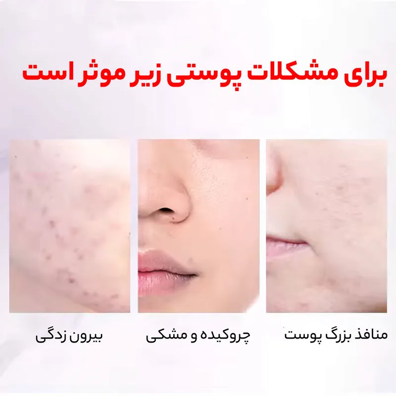 تونر پاک کننده صورت سرسان لاو مدل هلو حجم 400 میلی لیتر - تصویر 5