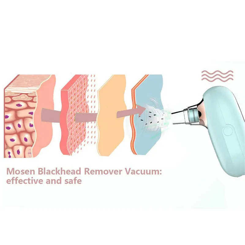 میکرودرم خانگی موسن کد 7531 - تصویر 3