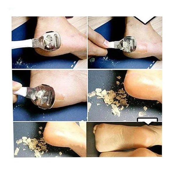 تیغ کف پا سابرلی مدل T1 به همراه تیغ یدک مدل 001  بسته 5 عددی - تصویر 2